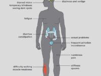 558263-symptoms-of-MS-women-english-1296×2880-body